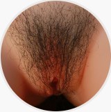 implanted pubic hair #1