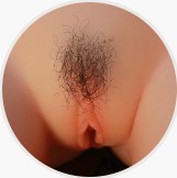 implanted pubic hair #3