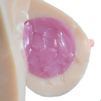 Jelly breast