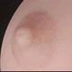 Skin Areola