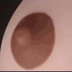 Dark Brown Areola