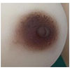 Brown Breast