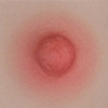 Pink areola