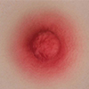 Natural Breast