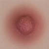 Light Brown Breast