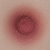 05 Breast