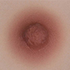 Brown Breast