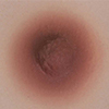 06 Breast