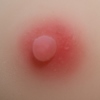 #1 areola