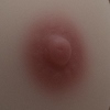 #2 Breast