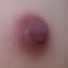#3 Breast