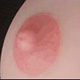 Pink Areola Color
