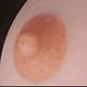 Brown Areola Color