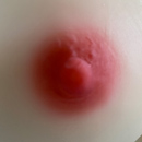 #1 Areola Color