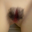 Pubic-Hair