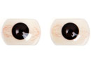 Black eyes