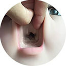 None Mouth Type