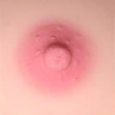 #1 Areola
