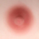 #2 Areola