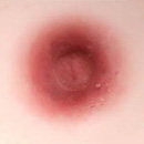 #3 Areola