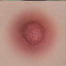 #3 Areola Color