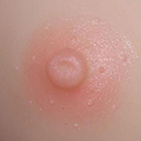 Pink Areola Color