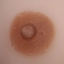 Dark Brown Areola Color